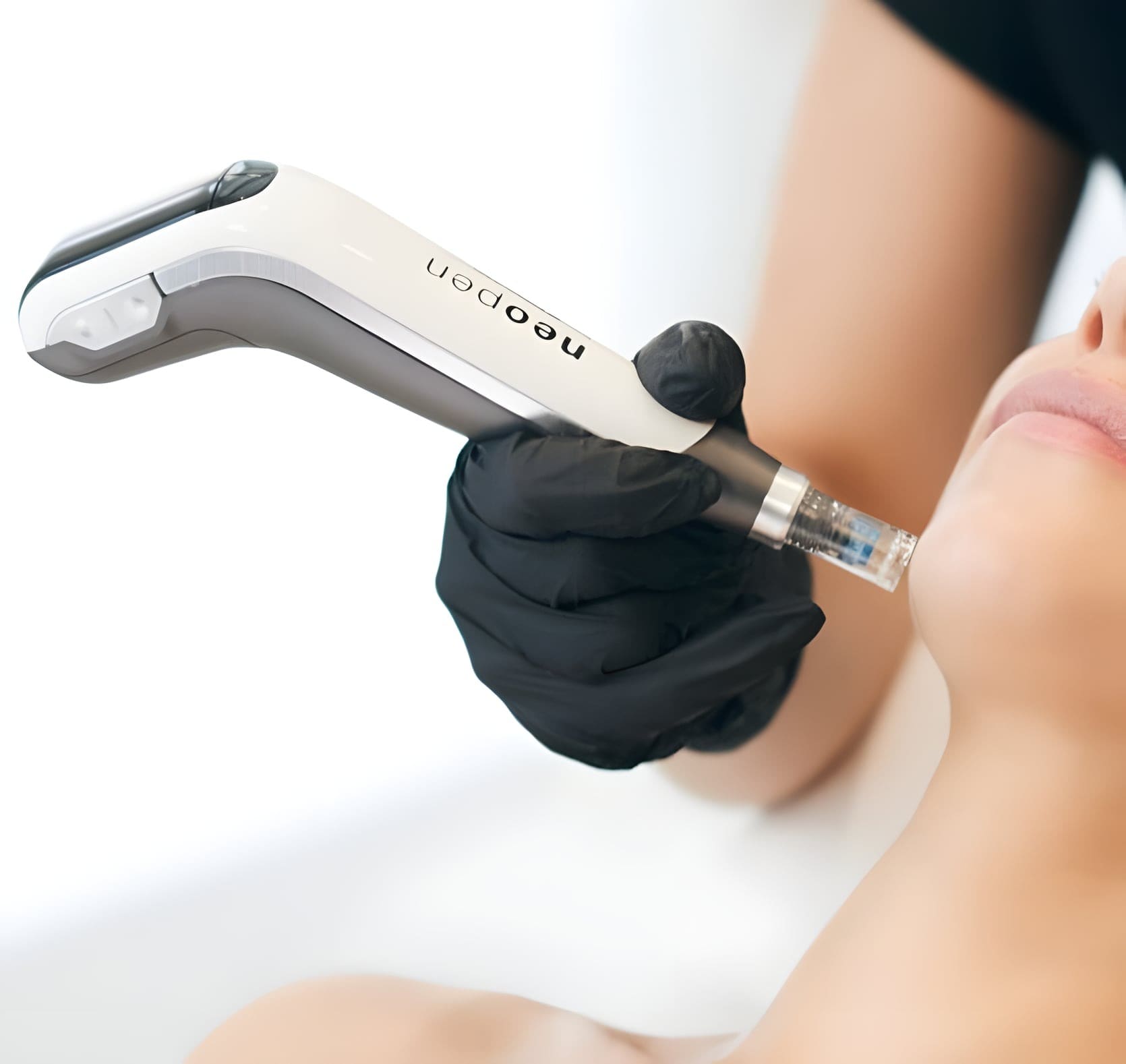 De Neopen microneedling pen in gebruik bij Beautycol in Twello